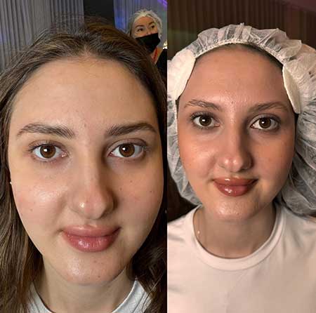 Julia-1